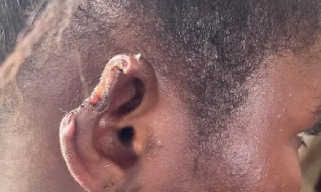 Police sued for GH₵15m over chopped ear of pregnant woman